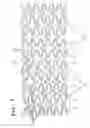 Fig. 04 - Radially expandable vessel support
