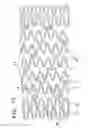 Fig. 09 - Radially expandable vessel support