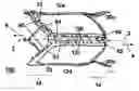 Fig. 01 - Medical device including remodelable material attached to frame