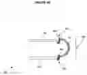 Fig. 05 - Medical device including remodelable material attached to frame
