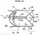 Fig. 08 - Medical device including remodelable material attached to frame