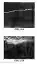 Fig. 17 - Nanoporous stents with magnesium leaching