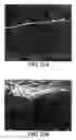 Fig. 17 - Nanoporous stents with improved radiolucency