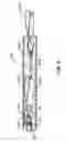 Fig. 07 - Mitral valve annuloplasty device with twisted anchor