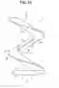 Fig. 02 - Intervertebral ligament having a helical bone fastener