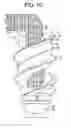 Fig. 04 - Intervertebral ligament having a helical bone fastener