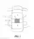 Fig. 02 - Implant for stabilizing a bone graft during spinal fusion