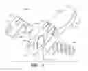 Fig. 05 - Implant for stabilizing a bone graft during spinal fusion