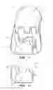 Fig. 06 - Implant for stabilizing a bone graft during spinal fusion