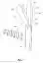 Fig. 14 - Implant for stabilizing a bone graft during spinal fusion