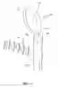 Fig. 15 - Implant for stabilizing a bone graft during spinal fusion