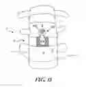 Fig. 17 - Implant for stabilizing a bone graft during spinal fusion