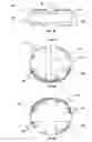 Fig. 04 - Anatomic total disc replacement
