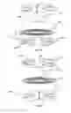 Fig. 05 - Anatomic total disc replacement
