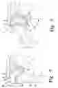 Fig. 03 - Procedure for the treatment of cuff tear arthropathy
