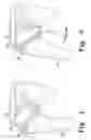 Fig. 04 - Procedure for the treatment of cuff tear arthropathy
