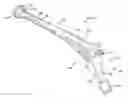 Fig. 01 - Fully porous prosthetic hip stem