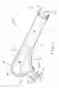 Fig. 02 - Fully porous prosthetic hip stem