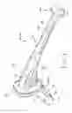 Fig. 04 - Fully porous prosthetic hip stem