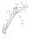 Fig. 05 - Fully porous prosthetic hip stem