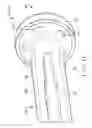 Fig. 12 - Fully porous prosthetic hip stem