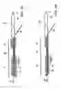 Fig. 04 - Male urethral stent device