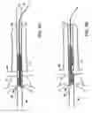Fig. 05 - Male urethral stent device