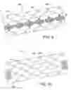 Fig. 07 - Endoprostheses