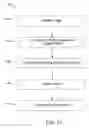 Fig. 08 - Endoprostheses