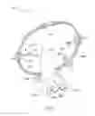 Fig. 07 - Rehabilitation methods