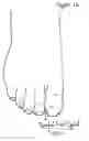 Fig. 02 - Maria's sandal hosiery