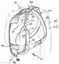 Fig. 01 - Chest protector