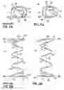 Fig. 04 - Bedding or seating product made with coil springs having unknotted end turns