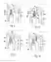 Fig. 03 - Hinge having fixedly engaged hinge means