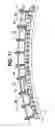 Fig. 09 - Conformal vacuum cup apparatus and method