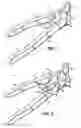 Fig. 02 - Tile nippers