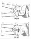 Fig. 03 - Tile nippers