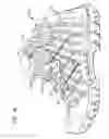 Fig. 20 - Chimney structures for apparel