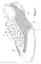 Fig. 08 - Simplified shoe construction with midsole having overmolded insert