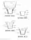 Fig. 13 - Method of wrapping a flower pot with a cover having an expandable portion