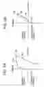 Fig. 03 - Method for improving residual stress in pipe and apparatus