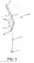 Fig. 04 - Garment, preferably for nursing, and method for providing such