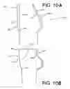 Fig. 11 - Garment, preferably for nursing, and method for providing such