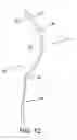 Fig. 13 - Garment, preferably for nursing, and method for providing such