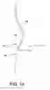 Fig. 15 - Garment, preferably for nursing, and method for providing such