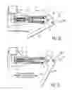 Fig. 11 - METER RING LOCKING DEVICE