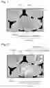 Fig. 02 - Sintered valve seat and production method therefor