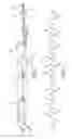 Fig. 04 - Replacement discharge electrode for electrostatic precipitators and method of assembly