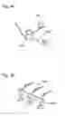 Fig. 09 - Sodium bicarbonate vacuum bag inserts