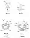 Fig. 06 - Forehead rest for respiratory masks